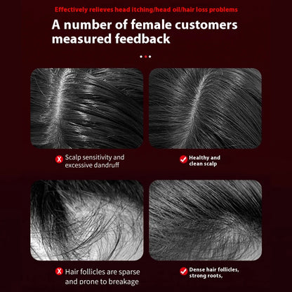 Red Light Vibration Head Massage Comb Electric Massage Comb Oil Applicator Nourishing Scalp Brush Hair Growth Anti Hair Loss