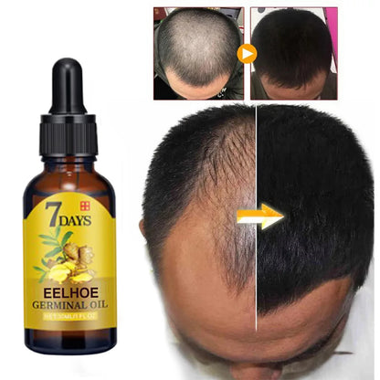 Ginger Hair Care Liquid Prevent Hair Loss Nourish Hair Follicles Strengthen Hair Roots Increase Hair Luster Nutrition Essence