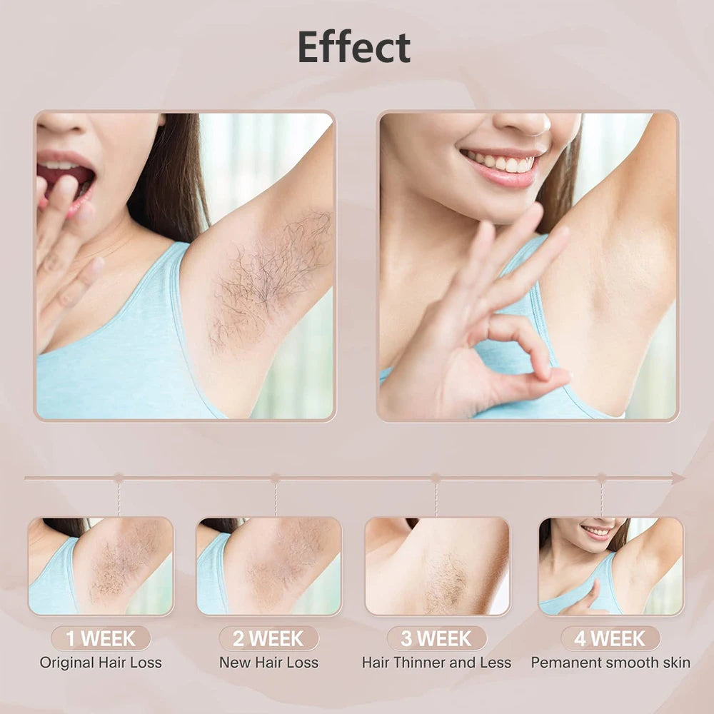 Portable IPL Laser Epilator 999999 Flashes - Painless, Permanent Hair Removal for Women’s Body and Bikini Line