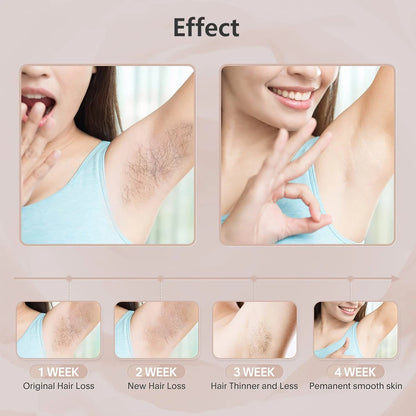 Portable IPL Laser Epilator 999999 Flashes - Painless, Permanent Hair Removal for Women’s Body and Bikini Line