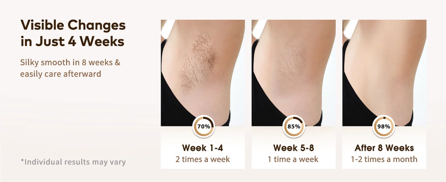 Permanent Laser Hair Removal Device Results in 4 Weeks Painless IPL Epilator 9 Levels 999900 Flashes Home Whole Body Treatment