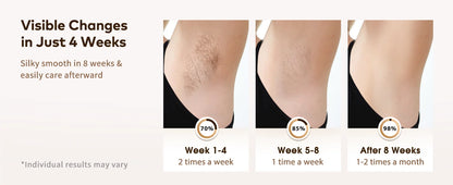 Permanent Laser Hair Removal Device Results in 4 Weeks Painless IPL Epilator 9 Levels 999900 Flashes Home Whole Body Treatment