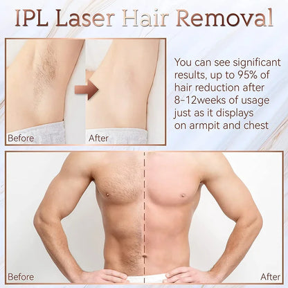 Body Bikini IPL 999,999 Flashes Depilator Pulses Permanent Laser Epilator Painless For Women Hair Removal Home Use Devices