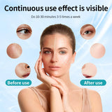 7 Color LED Face Mask with Neck - Wireless Portable Red Light Therapy for Anti-Aging, Wrinkles, Skin Rejuvenation, Home Use