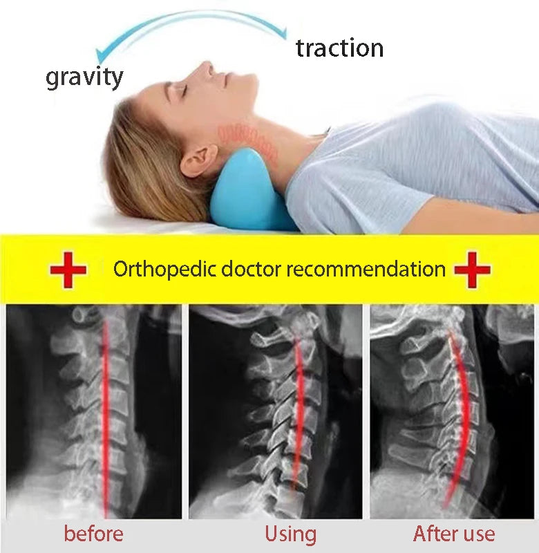  X-ray comparison showing spine improvement before and after using traction neck pillow