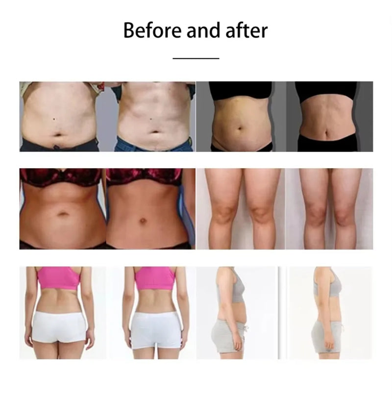 Before and after results of using EMS slimming machine for fat reduction and muscle toning.