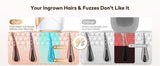  IPL vs Other Hair Removal Devices – 600nm Wavelength Comparison