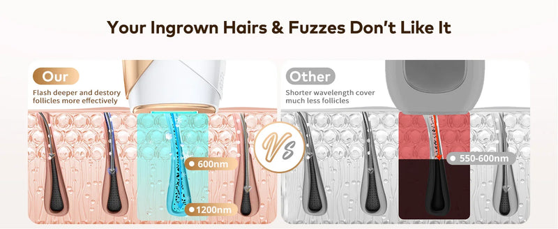  IPL vs Other Hair Removal Devices – 600nm Wavelength Comparison