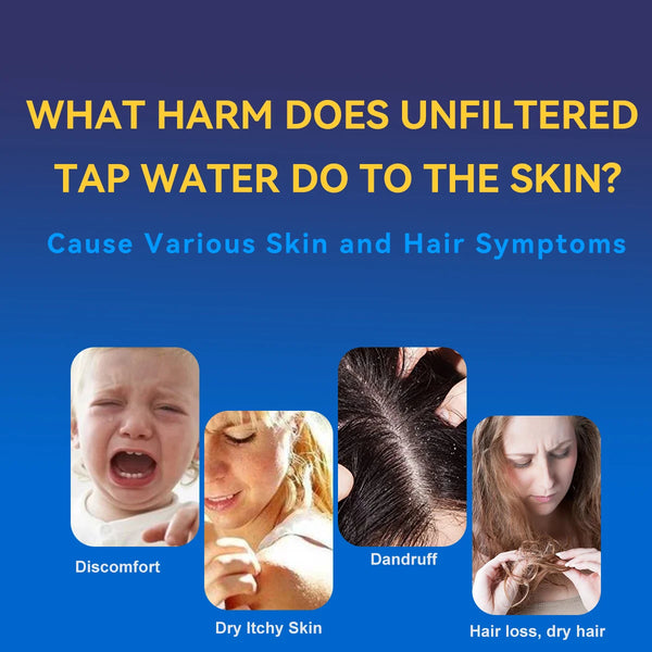 Effects of Unfiltered Tap Water – Dry Skin, Dandruff, Hair Loss